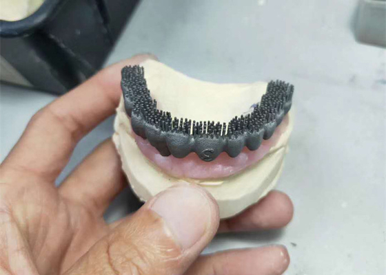 Dauerhafter Drucker Dental Lab Prints CAD-Nockens PFM 3D für Forschung