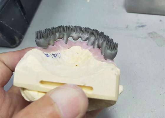 Dauerhafter Drucker Dental Lab Prints CAD-Nockens PFM 3D für Forschung