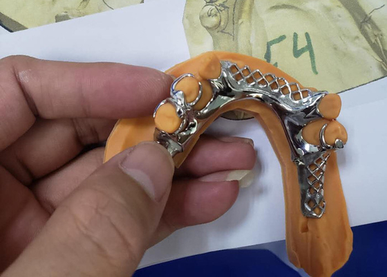 3D, das entfernbare zahnmedizinische Kronen-Rahmen-Modelle für Zahnheilkunde druckt