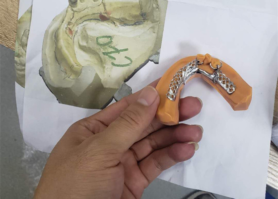 3D, das entfernbare zahnmedizinische Kronen-Rahmen-Modelle für Zahnheilkunde druckt