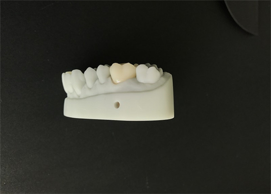 Soem 3D druckte zahnmedizinischen Modelle CAD-Nocken-Entwurf für Gebiss-Labor