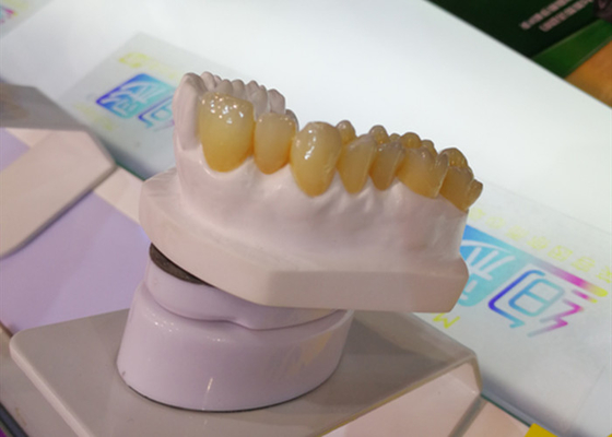DES CAD-Nocken-Entwurfs-PFM zahnmedizinischer Drucker Dental Crowns Kronen-Labor3d