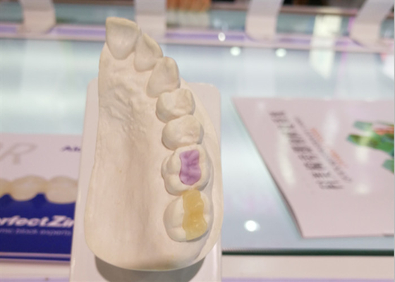 Kundenspezifische kundenspezifische zahnmedizinische Keramik FDA-Vollkeramik-Krone mit hoher Dichte