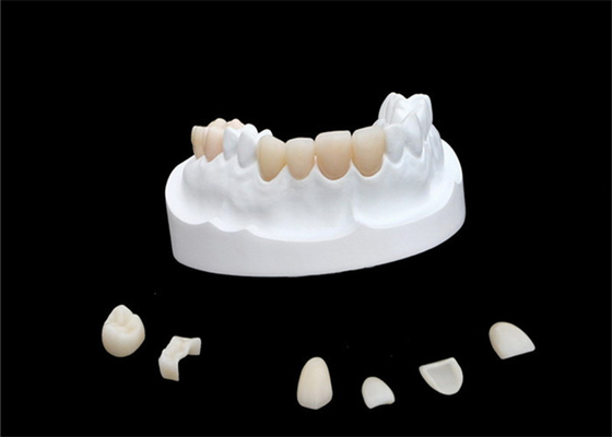 Porzellan-zusammengesetzte Furnier-Blätter IPS E Max Ceramic Dental Crown Comfortable