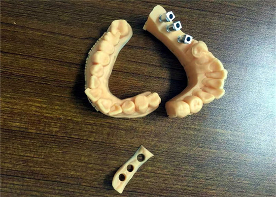 FDA 3D druckte zahnmedizinische Modell-das zahnmedizinische Kronen-Porzellan, das fixiert wurde, um zu asphaltieren
