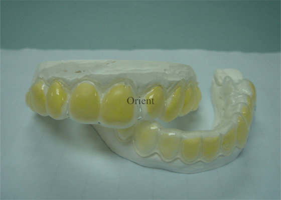 Orthodontische Geräte FDAs sind korrosionsbeständig und dauerhaft