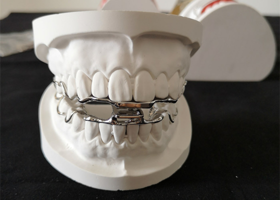 Hochfester 3D Digital Entwurf Soems zahnmedizinische orthodontische Gerät