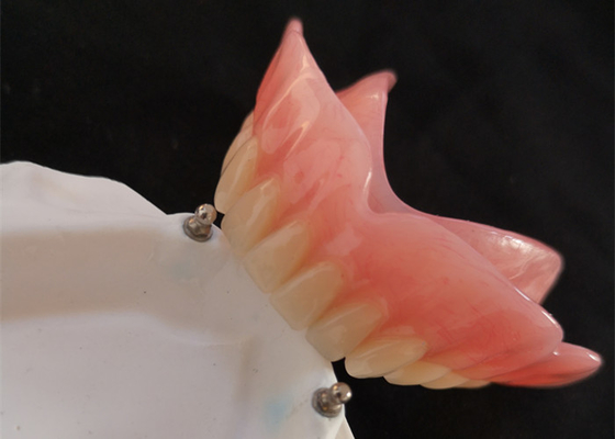 Hohes Implantat des Biocompatibility-Präzisions-Zubehör-Gebiss-CAD-CAM