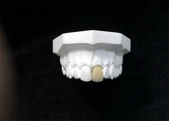 Gute Biocompatibility-Porzellan-zahnmedizinische Kronen-High-Teches biologisches Material