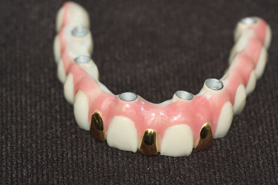 Präzision Digital 3D, die das Zahnimplantat-Stangen-Metall basiert druckt