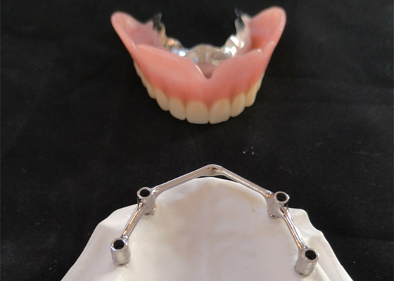 Zahnimplantate COCR-Zahn-Implantats-Krone FDAs mit Titanstange