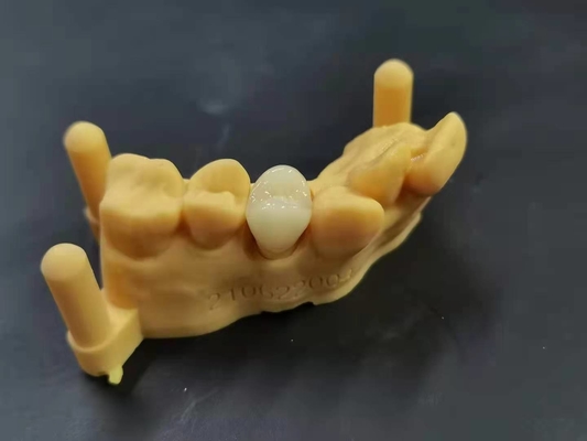 Soem 3D, das Digital-Entwurf Labor des flexiblen Acrylgebisses zahnmedizinischen druckt