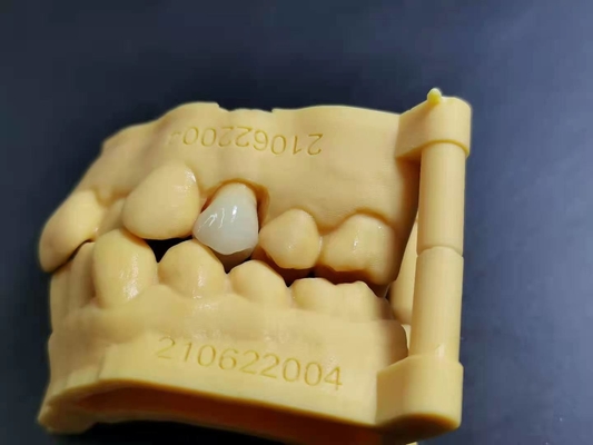 Soem 3D, das Digital-Entwurf Labor des flexiblen Acrylgebisses zahnmedizinischen druckt