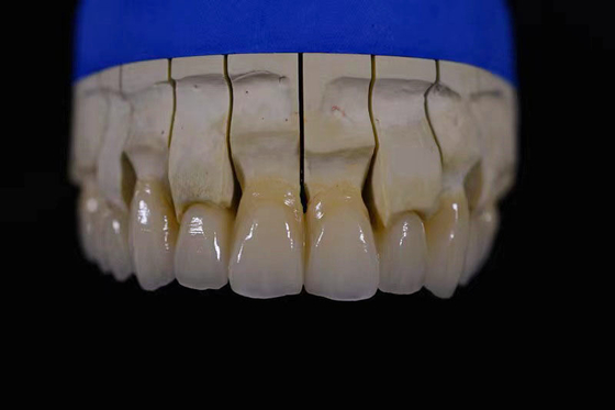 Labor für Zahnersatzherstellung Vollständig weiße Zahnersätze mit Zirkonia Reparatur