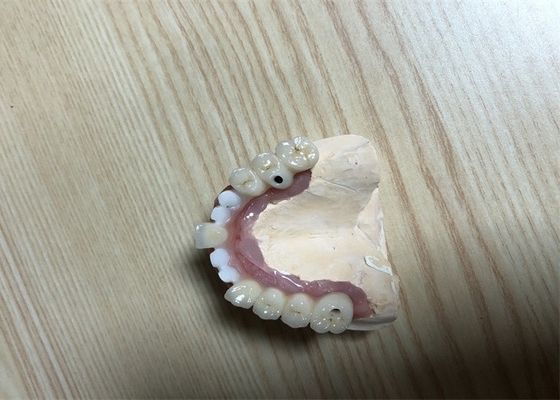 Genaue Zahnimplantat-Zubehör-Zahn-Implantats-Krone Biocompatibility