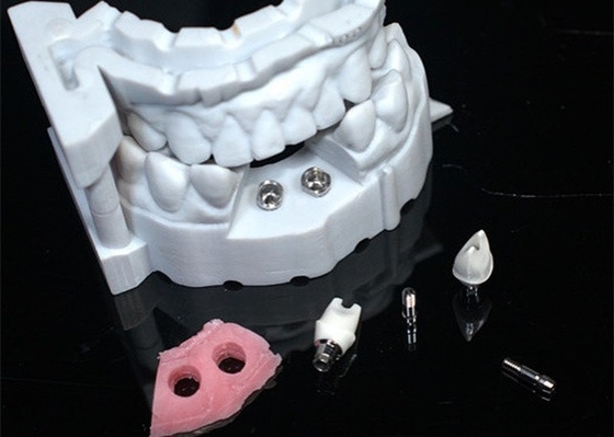 3D-Modell Zirkonia-Krone