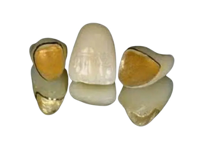 Glatte Oberflächen-PFM-Metallporzellan-Zahn-realistischer Farbdigital-analog-wandlung Entwurf